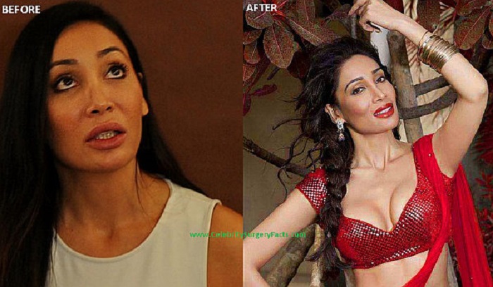 List Of Bollywood Actresses Who Have Had Cosmetic Surgery Some Are Disasters Meneses Acurnhooks