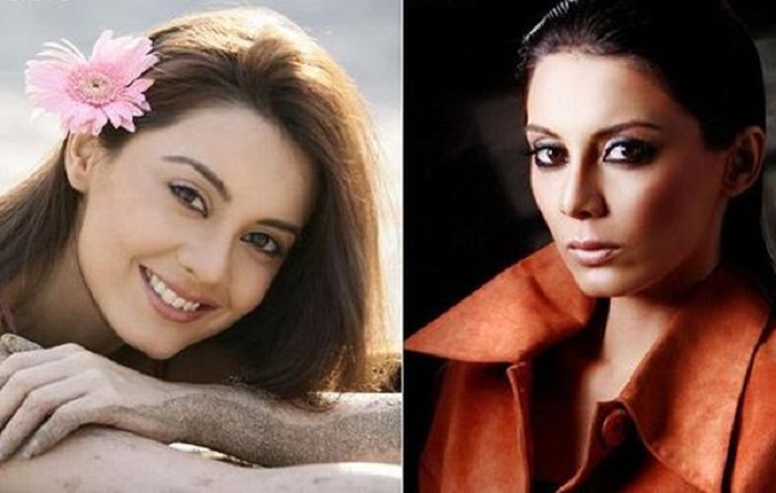 List Of Bollywood Actresses Who Have Had Cosmetic Surgery Some Are Disasters