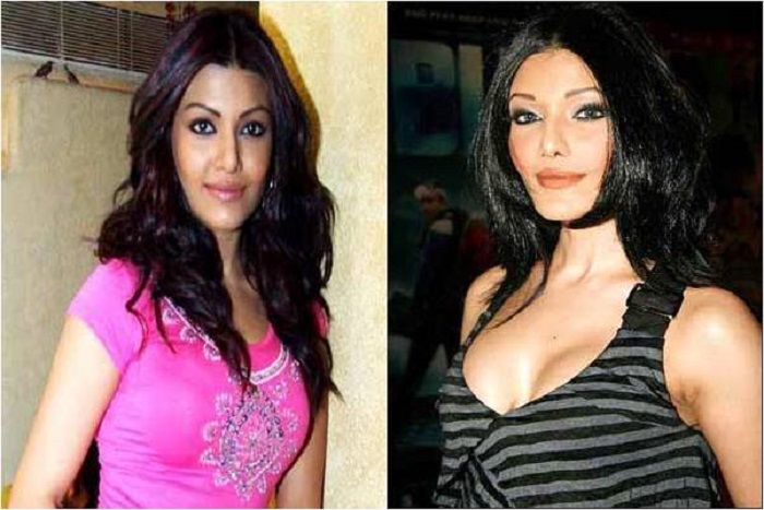 Koeina Mitra Bollywood Actress Plastic Surgery