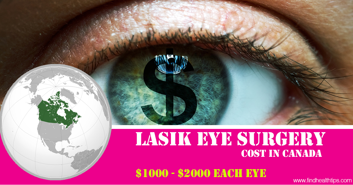 How Much Does Lasik Eye Surgery Cost (Cheap To High