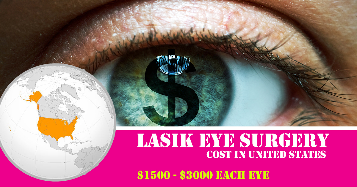How Much Does Lasik Eye Surgery Cost (Cheap To High)? Find Health Tips