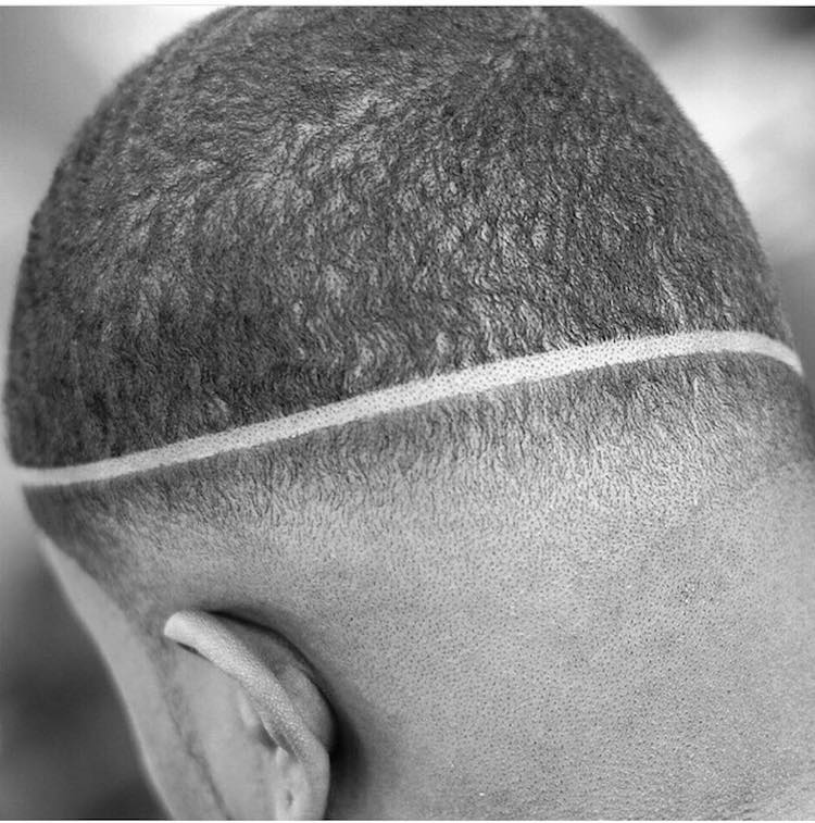 A man showing the back view of his Surgical Line hairstyle - Latest Hair Cut for Men and Boys
