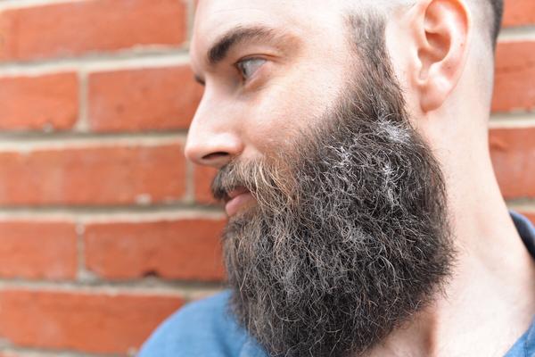 beards with dandruff