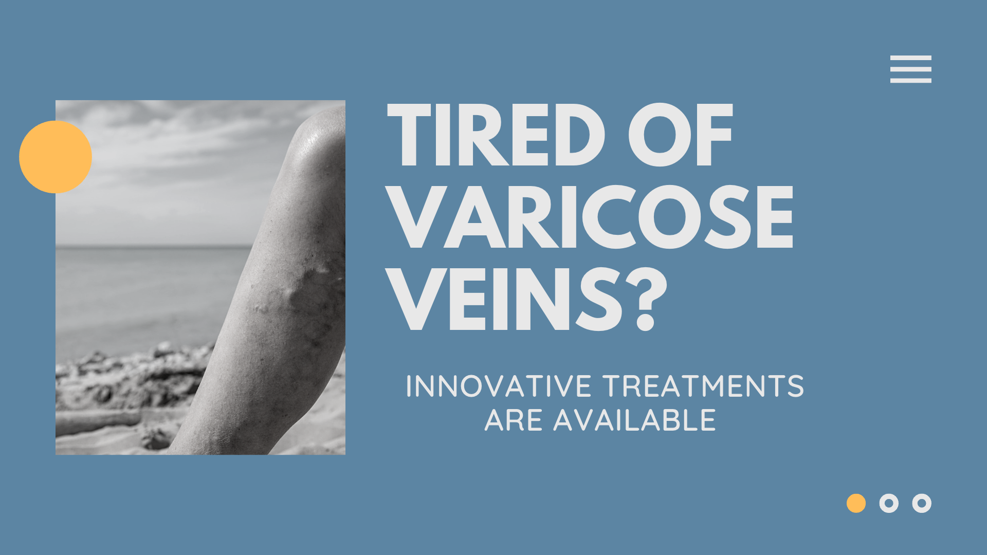 Tired Of Varicose Veins Here Are The Innovative Treatments Available