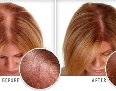 Hair Growth Tips for Women