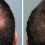 Hair Growth Tips