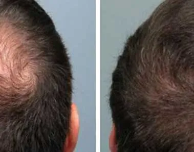 Hair Growth Tips