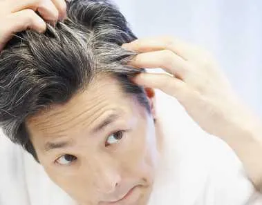 Home Remedies for Premature Graying of Hair 1 premature gray hair