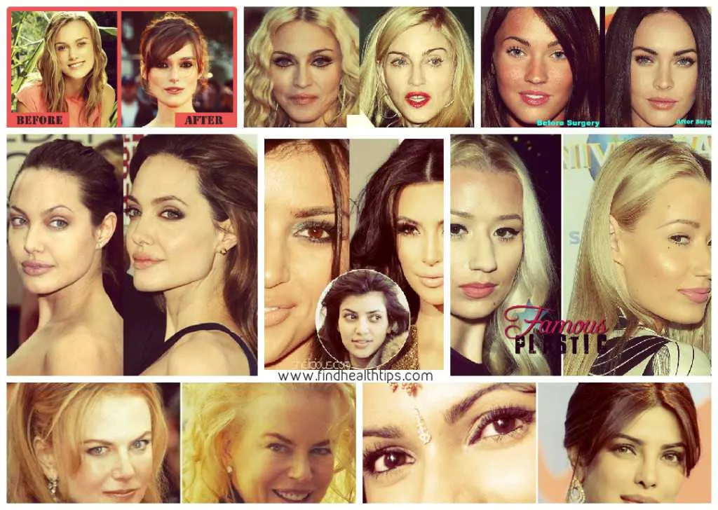 Top Celebrities Who Have Done Plastic Surgery