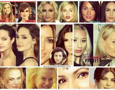 Top Celebrities who have Done Plastic Surgery