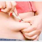 Weight loss surgery facts