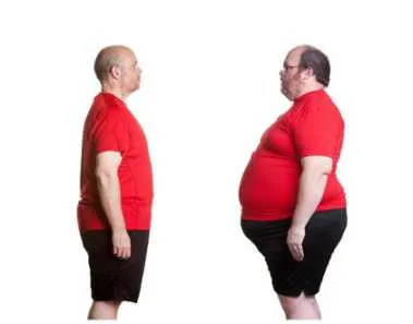 weight loss surgery