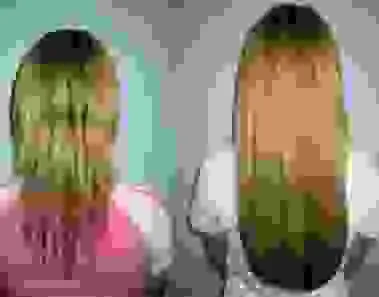 Hair Growth