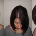 How to Prevent Hair Loss While Losing Weight 1