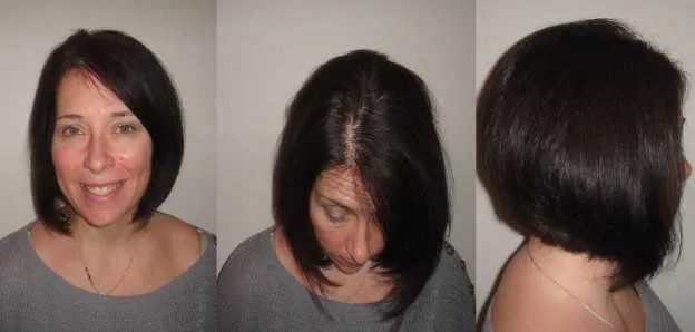 How to Prevent Hair Loss While Losing Weight