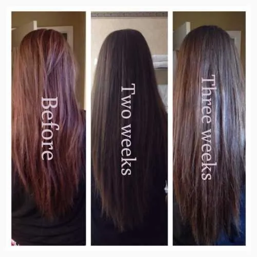 Top Vitamin Supplements for Hair Growth