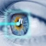 lasik eye surgery