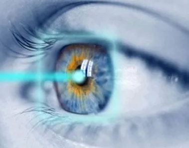 The Safety and Risks of Laser Surgery for Eye Treatment 1 lasik eye surgery
