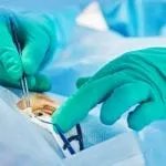 lasik eye surgery information