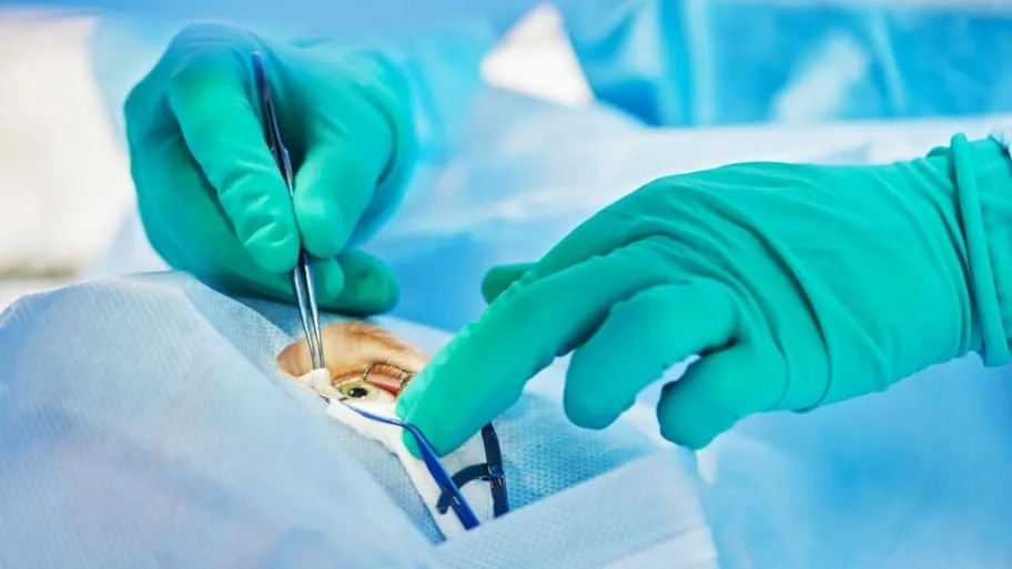 Guide of Lasik Eye Surgery – Information, Side effects and Preparation