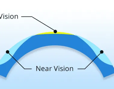 Presbyopia Eye Surgery