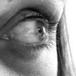lasik eye surgery painful