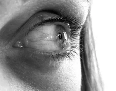 Is Lasik Eye Surgery Painful? 1 lasik eye surgery painful