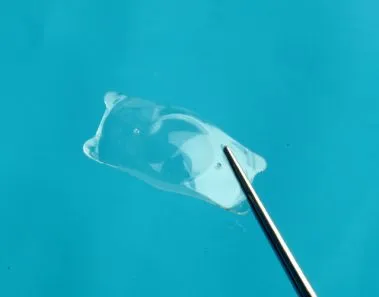 ICL: Implantable Collamer Lenses Explained 1 collamer lenses