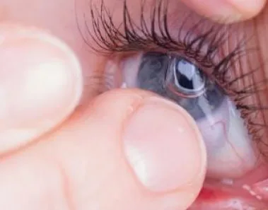 contact lens intolerance