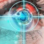 lasik eye surgeons in new york