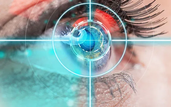 Best Lasik Eye Surgery in New York? List of Lasik Surgeons in New York