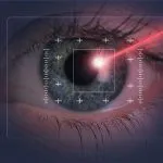 lasik surgery tips