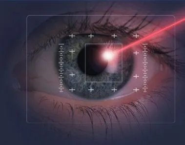 lasik surgery tips