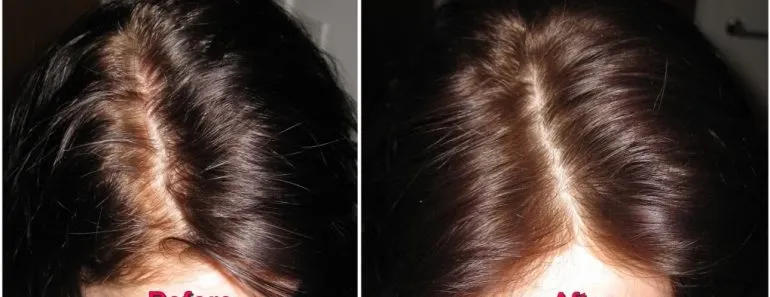 dry shampoos reviews