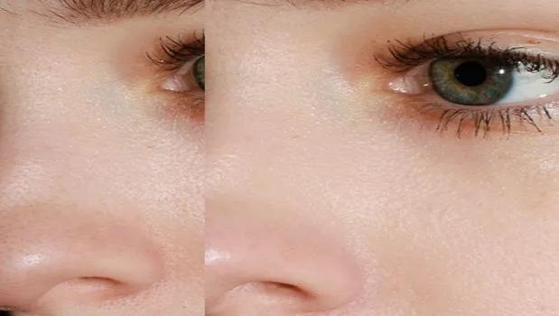 Top 5 Skin Pore Minimizing Products in India