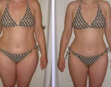 HCG Weight Loss