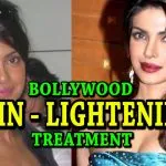 skin lightening treatment