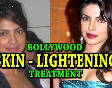 skin lightening treatment