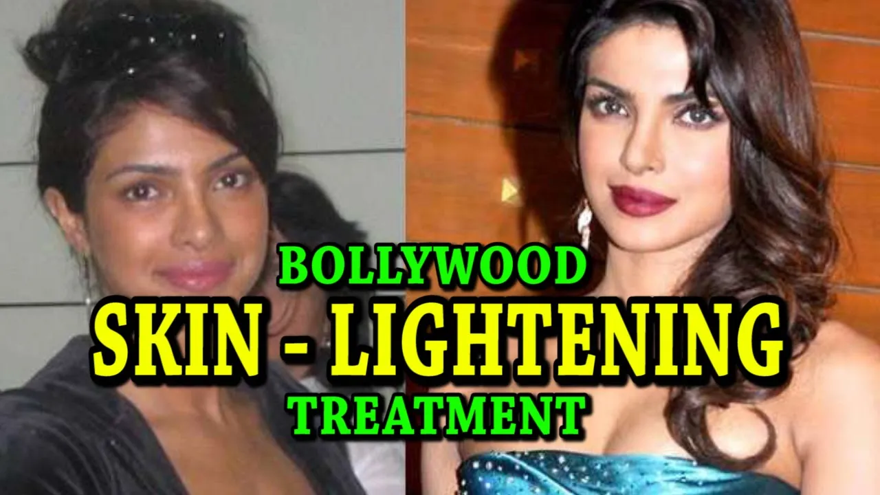skin lightening treatment