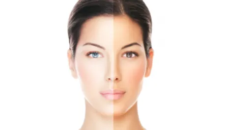 skin lightening skin lightening