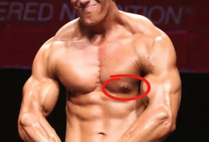 Effects of Steriods on Adults (Advantages and Disadvantages)