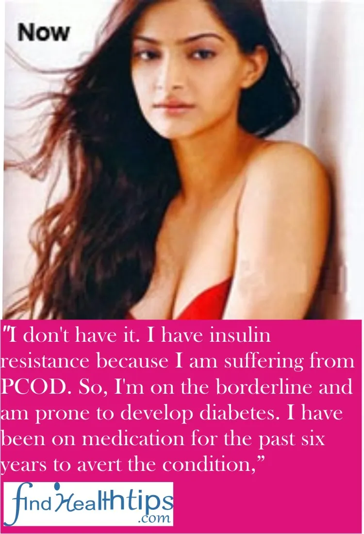 How Healthy are Your Favorite Bollywood Celebrities? 2 sonam kapoor health quote