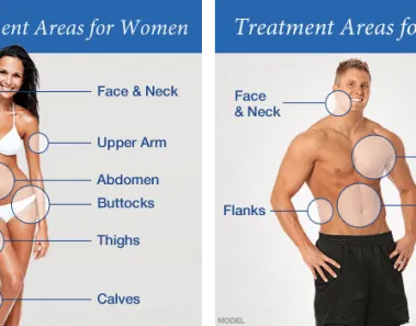 Common Areas That Liposuction Can Treat 1 liposuction fat loss surgery