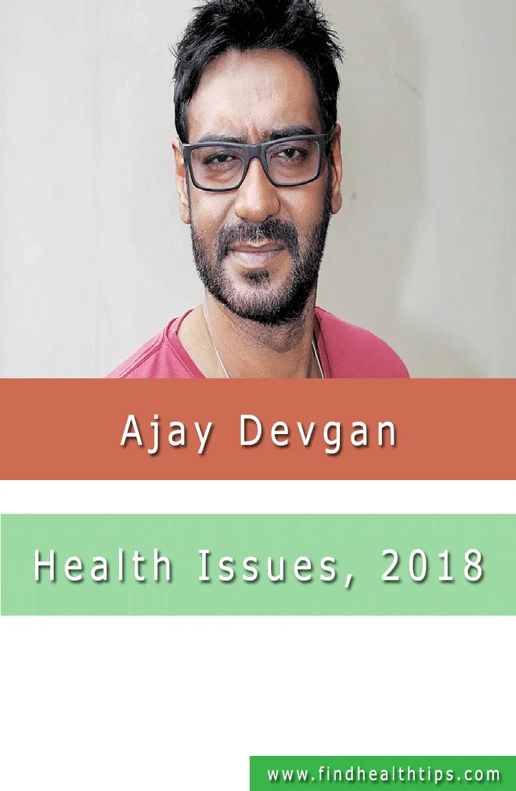Ajay Devgn Health Issue 2018