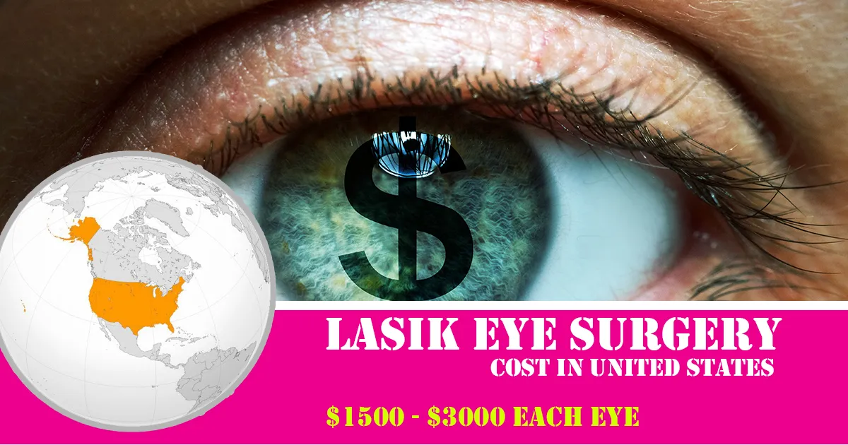 lasik eye surgery cost in united states