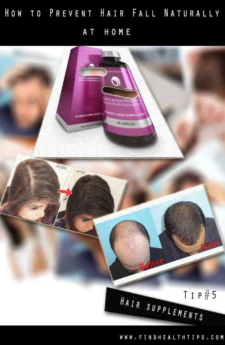 How to Prevent Hair Fall Naturally at Home 7 Prevent Hair Fall Naturally Tips