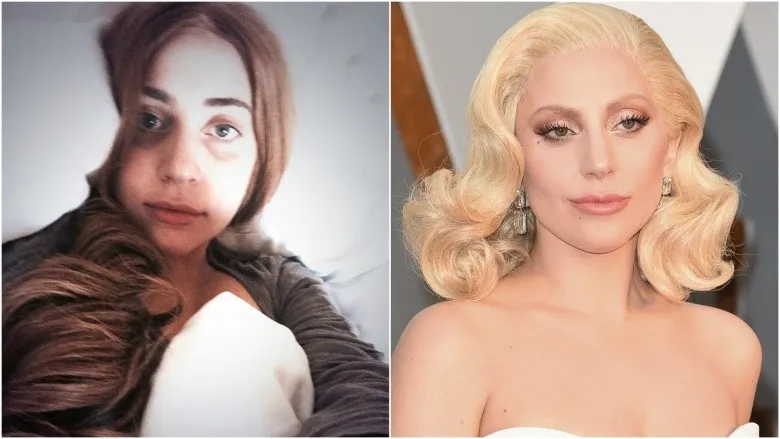 Lady Gaga with makeup and without makeup photos Lady Gaga with makeup and without makeup photos - hollywood actresses without makeup 2022