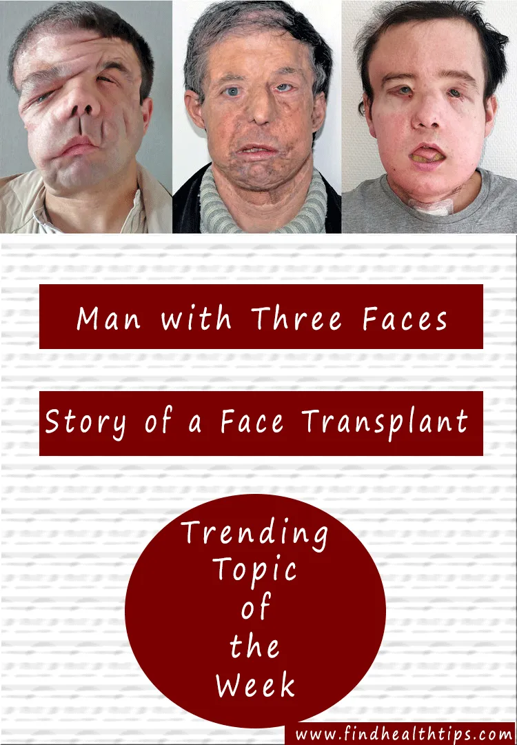 man three faces Jerome Hamon face transplant