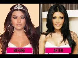Bollywood Female Celebrities Plastic Surgery Before and After 1 C:\Users\Elcot\Downloads\1.jpg