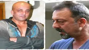 List of Chain Smokers in Bollywood 7 Sanjay Dutt Plastic Surgery